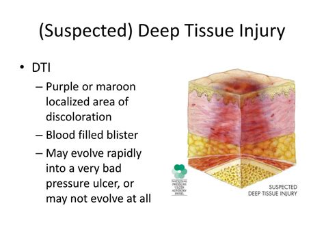 dti meaning|dti meaning medical wound.